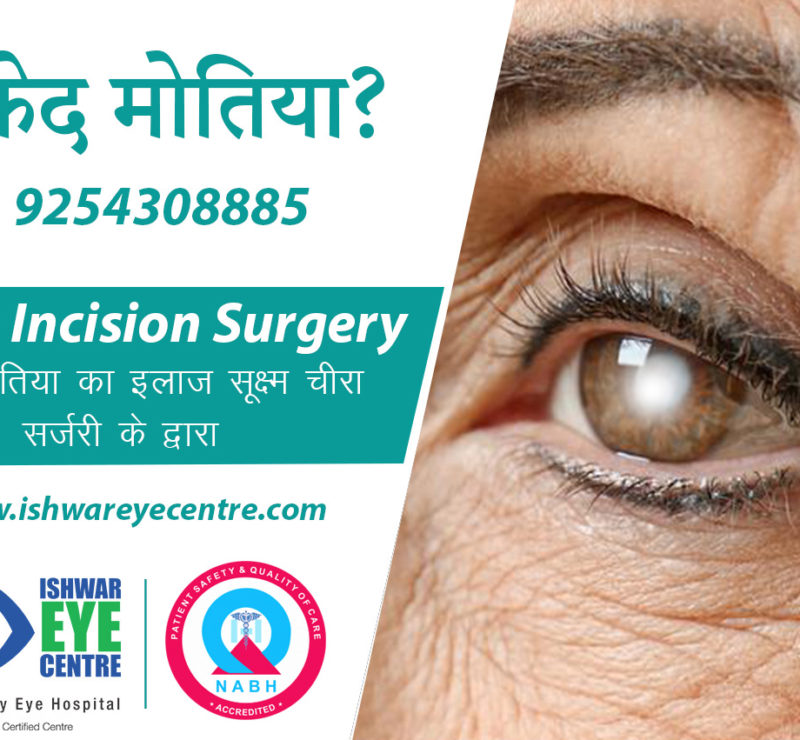 Best Cataract Surgery in Delhi NCR