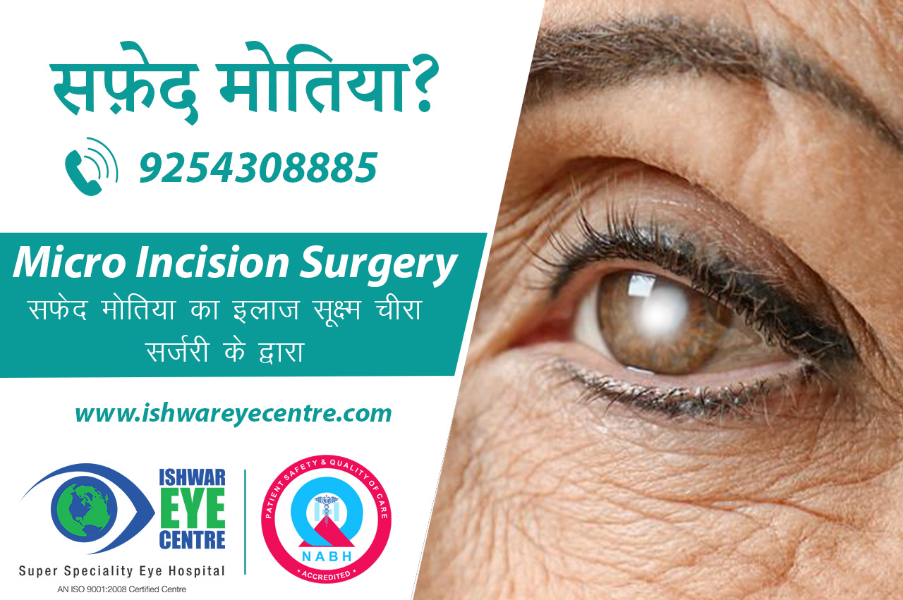 Best Cataract Surgery in Delhi NCR